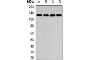 Western blot analysis of DAAM2 expression in A375 (A), mouse kidney (B), mouse lung (C), rat brain (D) whole cell lysates. (DAAM2 抗体)