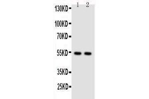 Western Blotting (WB) image for anti-Nuclear Factor of kappa Light Polypeptide Gene Enhancer in B-Cells 2 (NFKB2) (AA 5-21), (N-Term) antibody (ABIN3044018)