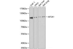 Western blot analysis of extracts of various cell lines using AP2A1 Polyclonal Antibody at dilution of 1:1000. (alpha Adaptin 抗体)