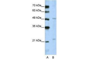 WB Suggested Anti-WDR12 Antibody Titration:  5. (WDR12 抗体  (C-Term))