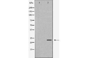 Western blot analysis of extracts of SW480, using LCN2 antibody. (Lipocalin 2 抗体  (Internal Region))