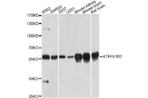 Western blot analysis of extracts of various cell lines, using ATP6V1B2 Antibody (ABIN5971942) at 1/1000 dilution. (ATP6V1B2 抗体)