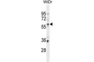 Western Blotting (WB) image for anti-beta-Carotene 15,15'-Monooxygenase 1 (BCMO1) antibody (ABIN2995663) (BCMO1 抗体)