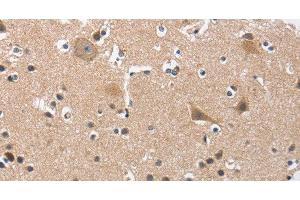 Immunohistochemistry of paraffin-embedded Human brain tissue using BUB1 Polyclonal Antibody at dilution 1:50 (BUB1 抗体)
