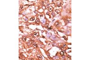 Image no. 2 for anti-Signal Transducer and Activator of Transcription 5A (STAT5A) (pSer726) antibody (ABIN358237) (STAT5A 抗体  (pSer726))
