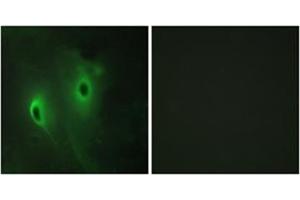 Immunofluorescence analysis of HeLa cells, using DUSP9 Antibody . (DUSP9 抗体  (Internal Region))
