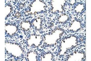 Image no. 1 for anti-Epithelial Membrane Protein 2 (EMP2) (C-Term) antibody (ABIN203481) (EMP2 抗体  (C-Term))