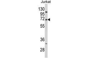 Western blot analysis of PCSK9 Antibody (N-term) in Jurkat cell line lysates (35ug/lane). (PCSK9 抗体  (N-Term))
