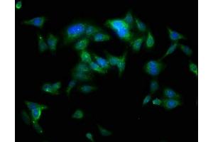 Immunofluorescence staining of HepG2 cells with ABIN7173996 at 1:100, counter-stained with DAPI. (YARS 抗体  (AA 2-528))