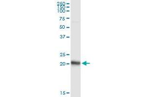 Immunoprecipitation of FNDC4 transfected lysate using anti-FNDC4 MaxPab rabbit polyclonal antibody and Protein A Magnetic Bead , and immunoblotted with FNDC4 MaxPab mouse polyclonal antibody (B01) .