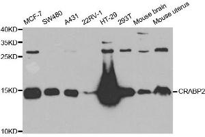Western Blotting (WB) image for anti-Cellular Retinoic Acid Binding Protein 2 (CRABP2) antibody (ABIN1882301) (CRABP2 抗体)