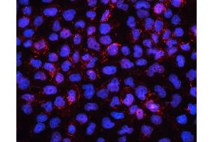 IF analysis of EHD1 using anti-EHD1 antibody (ABIN6719599).