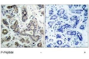 Image no. 1 for anti-BCL2-Associated Agonist of Cell Death (BAD) (pSer136), (pSer99) antibody (ABIN318335) (BAD 抗体  (pSer99, pSer136))