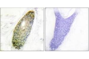 Immunohistochemistry analysis of paraffin-embedded human skin, using HDAC3 (Phospho-Ser424) Antibody. (HDAC3 抗体  (pSer424))