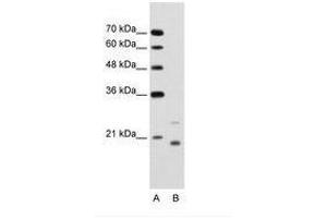Image no. 1 for anti-Ubiquitin-Conjugating Enzyme E2D 1 (UBE2D1) (AA 91-140) antibody (ABIN203473) (UBE2D1 抗体  (AA 91-140))