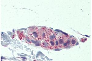 Human Small Intestine, submucosal plexus: Formalin-Fixed, Paraffin-Embedded (FFPE) (TNKS 抗体  (AA 972-1021))