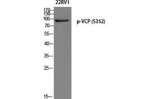 Western Blot (WB) analysis of 22RV1 using p-VCP (S352) antibody. (VCP 抗体  (pSer352))