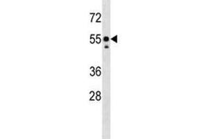 Western Blotting (WB) image for anti-Proto-oncogene tyrosine-protein kinase Src (Src) (AA 98-125) antibody (ABIN3029551)