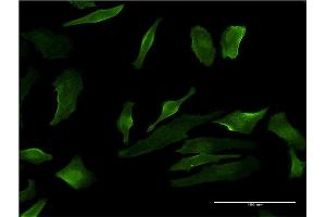 Immunofluorescence (IF) image for anti-Purinergic Receptor P2Y, G-Protein Coupled, 1 (P2RY1) (AA 1-52) antibody (ABIN518571)