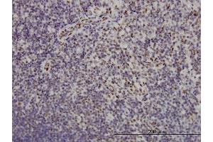 Immunoperoxidase of monoclonal antibody to TSC22D3 on formalin-fixed paraffin-embedded human lymph node. (TSC22D3 抗体  (AA 1-97))