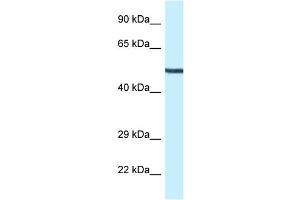 WB Suggested Anti-Map2k5 Antibody Titration: 1. (MAP2K5 抗体  (N-Term))
