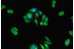 Immunofluorescent analysis of HepG2 cells using ABIN7159092 at dilution of 1:100 and Alexa Fluor 488-congugated AffiniPure Goat Anti-Rabbit IgG(H+L) (TMEM67 抗体  (AA 241-500))