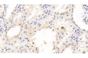 Detection of Kim1 in Human Kidney Tissue using Monoclonal Antibody to Kidney Injury Molecule 1 (Kim1) (HAVCR1 抗体  (AA 21-240))