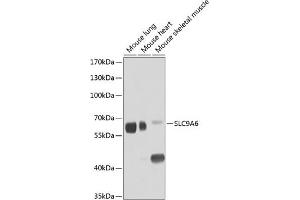 Western blot analysis of extracts of various cell lines, using SLC9 antibody (ABIN6131139, ABIN6148056, ABIN6148057 and ABIN6224211) at 1:1000 dilution. (SLC9A6 抗体  (AA 542-701))