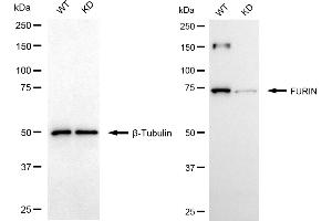 Western blotting analysis using FURIN antibody (ABIN7798668). (Recombinant FURIN 抗体)