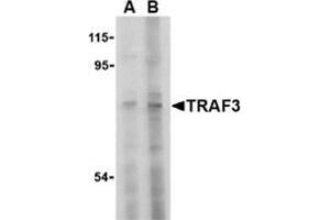Western blot analysis of TRAF3 in HeLa cell lysate with this product at (A) 2 and (B) 4 μg/ml. (TRAF3 抗体  (N-Term))