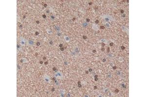 Used in DAB staining on fromalin fixed paraffin- embedded brain tissue (PUF60 抗体  (AA 226-549))