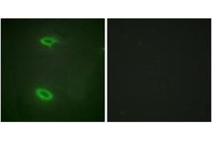 Immunofluorescence (IF) image for anti-Discs, Large (Drosophila) Homolog-Associated Protein 1 (DLGAP1) (AA 791-840) antibody (ABIN2889307) (DLGAP1 抗体  (AA 791-840))