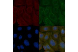 FAF2 Mouse Monoclonal Antibody staining Hela cells by IF/ICC.