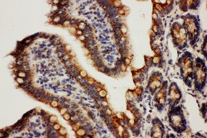 Immunohistochemistry (IHC) image for anti-Heat Shock 10kDa Protein 1 (Chaperonin 10) (HSPE1) (AA 81-102), (C-Term) antibody (ABIN3044176)