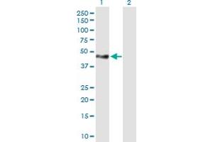 Western Blot analysis of TNS1 expression in transfected 293T cell line by TNS1 MaxPab polyclonal antibody. (Tensin 1 抗体  (AA 1-385))