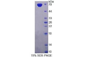 SDS-PAGE analysis of Rat PDE3A Protein. (PDE3A 蛋白)