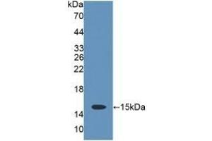 Detection of Recombinant CD7, Rat using Polyclonal Antibody to Cluster Of Differentiation 7 (CD7) (CD7 抗体  (AA 23-128))