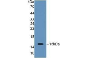 Detection of Recombinant CD7, Rat using Polyclonal Antibody to Cluster Of Differentiation 7 (CD7) (CD7 抗体  (AA 23-128))