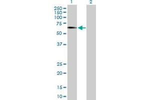 Western Blotting (WB) image for EGR2 293T Cell Transient Overexpression Lysate(Denatured) (ABIN1331669)
