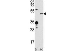 Western blot analysis of SIRT7 antibody and 293 cell lysate (2 ug/lane) either nontransfected (Lane 1) or transiently transfected with the SIRT7 gene (2). (SIRT7 抗体  (AA 331-360))
