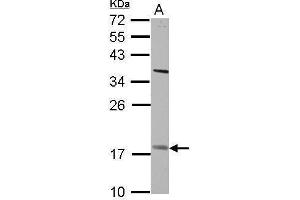 WB Image Sample (30 ug of whole cell lysate) A: H1299 12% SDS PAGE antibody diluted at 1:500 (PNPLA4 抗体)