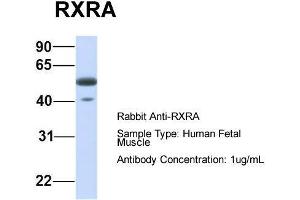 Host:  Rabbit  Target Name:  RXRA  Sample Type:  Human Fetal Muscle  Antibody Dilution:  1. (Retinoid X Receptor alpha 抗体  (N-Term))