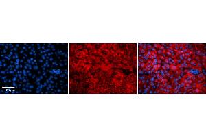 Rabbit Anti-Snf8 Antibody    Formalin Fixed Paraffin Embedded Tissue: Human Adult liver  Observed Staining: Cytoplasmic Primary Antibody Concentration: 1:100 Secondary Antibody: Donkey anti-Rabbit-Cy2/3 Secondary Antibody Concentration: 1:200 Magnification: 20X Exposure Time: 0. (SNF8 抗体  (N-Term))