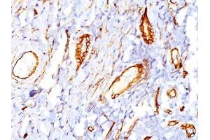 Image no. 1 for anti-CD34 (CD34) antibody (ABIN6185925)