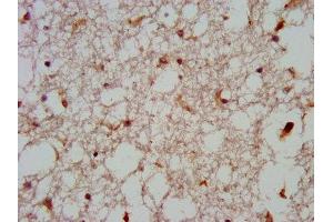 IHC image of ABIN7165031 diluted at 1:600 and staining in paraffin-embedded human brain tissue performed on a Leica BondTM system. (GNAS 抗体  (AA 310-404))