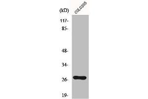 Western Blot analysis of Colo205 cells using OTUB2 Polyclonal Antibody (OTUB2 抗体  (Internal Region))