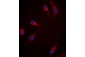 Immunofluorescent analysis of RRAD staining in HepG2 cells. (RRAD 抗体  (Center))