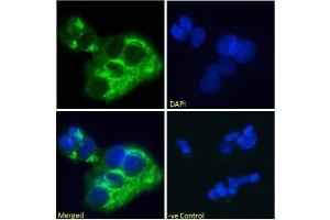 Immunofluoresence staining of fixed HepG2 cells with anti-Alpha-fetoprotein (AFP) antibody AF5. (Recombinant alpha Fetoprotein 抗体)