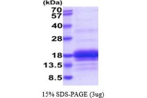 SDS-PAGE (SDS) image for CD3g Molecule, gamma (CD3-TCR Complex) (CD3G) (AA 23-116) protein (His tag) (ABIN6387995) (CD3G Protein (AA 23-116) (His tag))