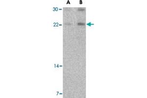 Western blot analysis of CBLN1 in mouse cerebellum tissue lysate with CBLN1 polyclonal antibody  at (A) 2 and (B) 4 ug/mL . (CBLN1 抗体  (Internal Region))